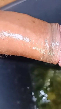 Collezione di urine - doccia dorata