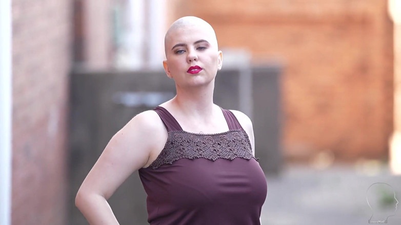 Euro Bald: Anne's New Haircut