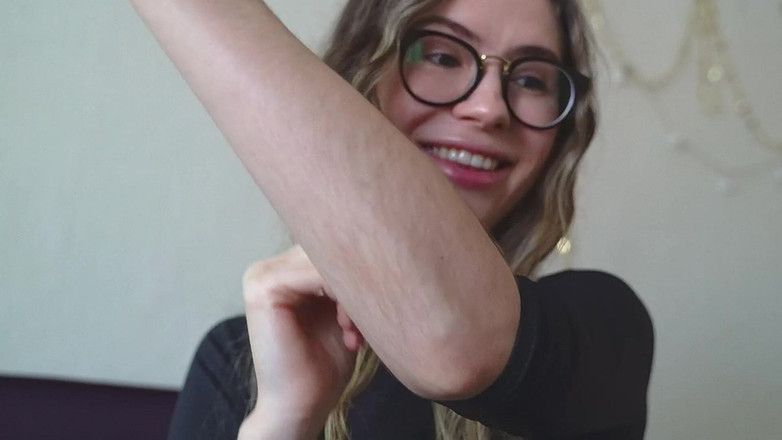 Rarible Diamond: बालों वाली Forearms कस्टम