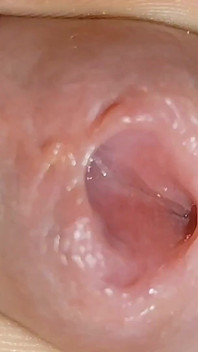 Amazing Glans with Two Cum Holes.