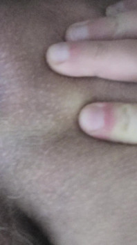 Dirty Anus