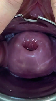 Glass Dildo Cervix Penetration