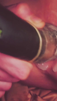 Dilatation Anal