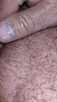 Anal Masturbation