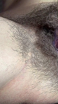 Hairy Mommy Clitoris Pumping,very Hot