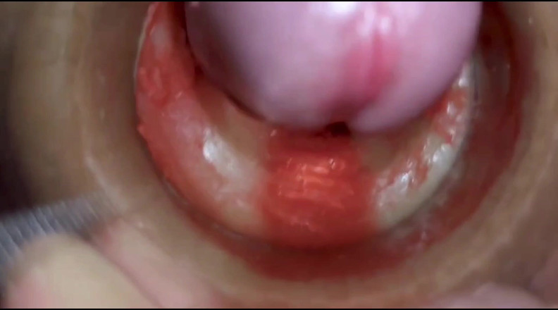 Creme sperm: Tổng Hợp Âm Hộ Crempie Hay Nhất - Camera Bên Trong 4K