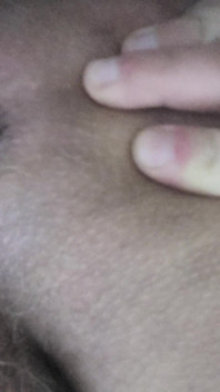 Dirty Anus