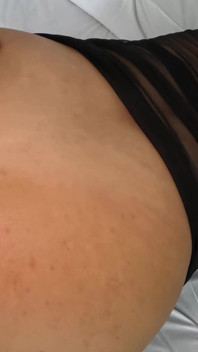 260 Paty Bumbum