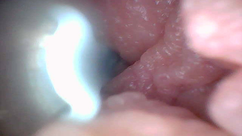 Twittiy: Echemos Un Vistazo a Mi Jugoso Coño Juntos (cámara De Endoscopio)