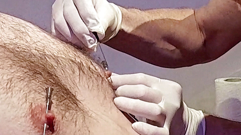 Master Drex: Sfarcurile