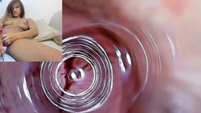 SexyGamingCouple: Rakaman kamera pepek endoskop creampie pada bulanannya dengan pepek merah...