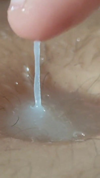 L'ombelico Profondo Si Trasforma in Un Serbatoio Di Sperma.
