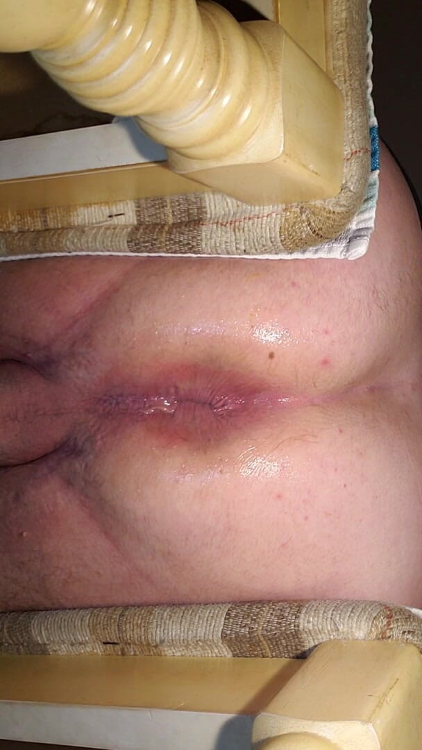 Charlieboy69: Dildo analne