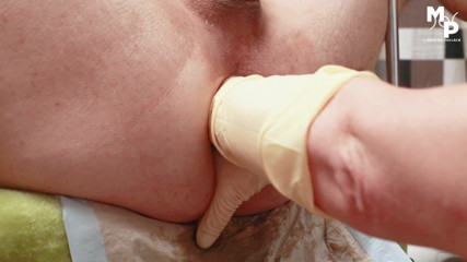 Marcus Pollack: Lento doble fisting por mi novia