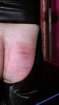 Flagellation sévère