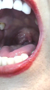 Dentro de mi gran boca, úvula de dientes de lengua