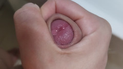 Bayer911: Setelah kencan seks yang buruk banget