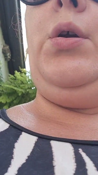 Sudden Stomach Cramps a Lot of Farts