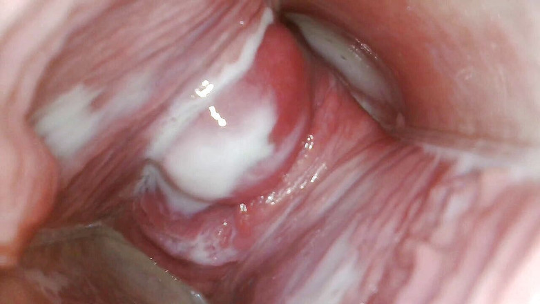 JANA studios: मेरी चूत में एंडोस्कोप