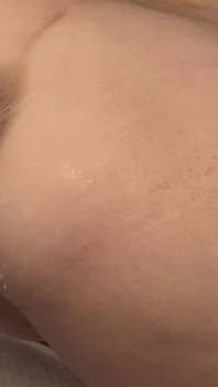Stříkání při anální pěsti