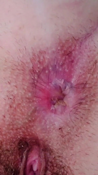 Stinky Hairy Asshole up Close