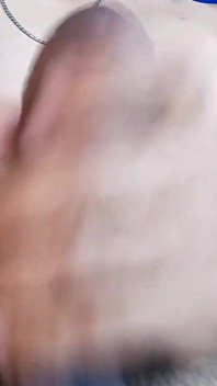 Precum, vorhautschnitt