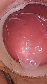 Kamera di memek dalam merekam ejakulasi besar sperma ke dalam kondom