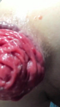 Sto scopando il mio enorme prolasso anale con un dildo