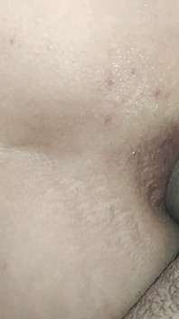 Side Anal