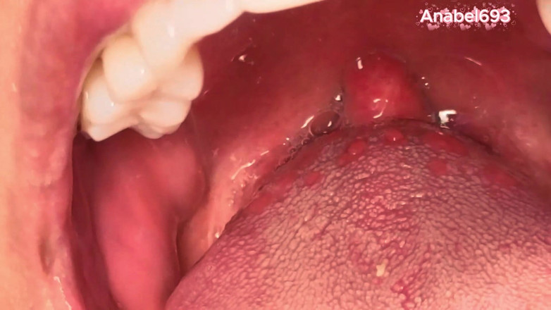 anabel693: Uvula Fetish