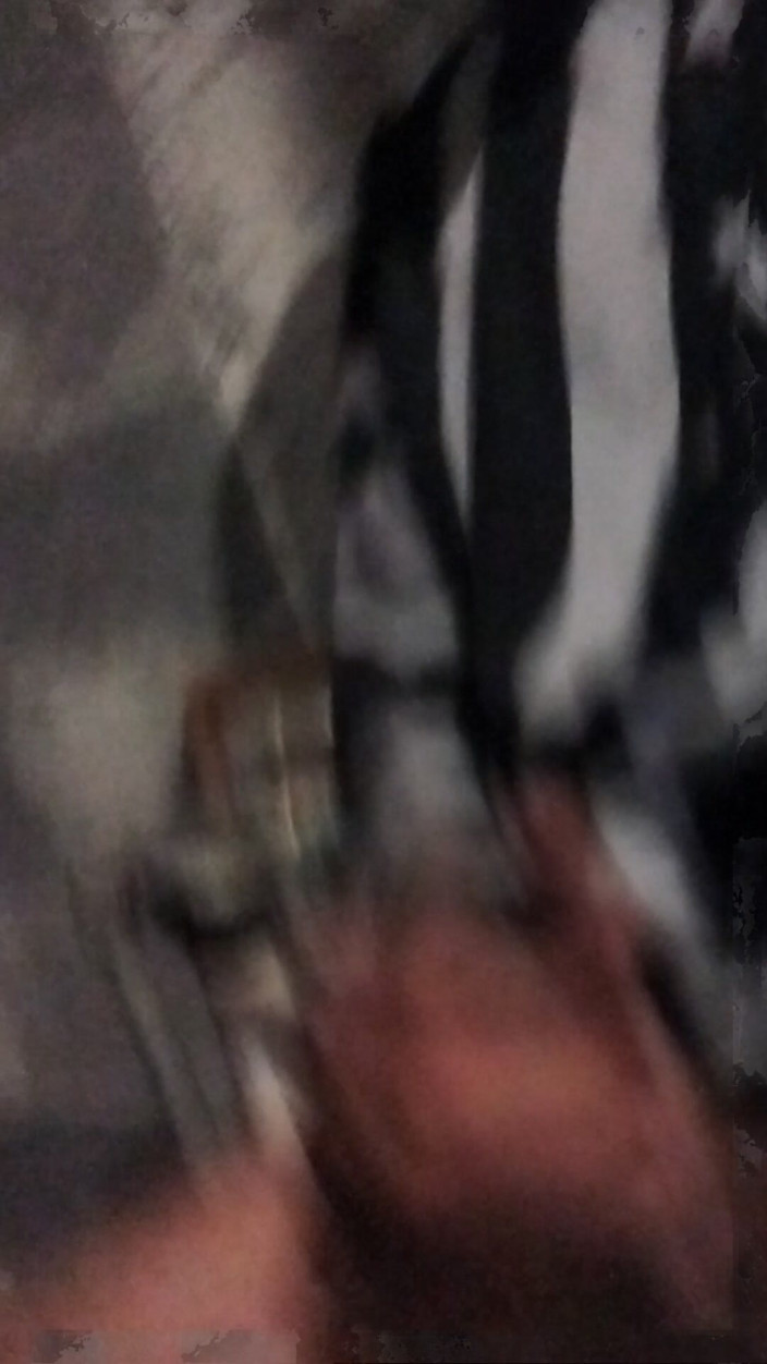 AlexAlejandro13: My Hand Exploded When Exposed to Masturbation