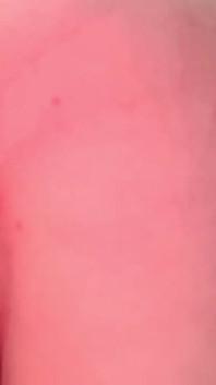 Redare