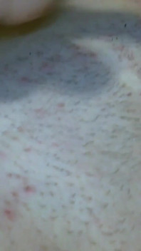 Saya melancap dan mengurut telur saya dengan sperma saya