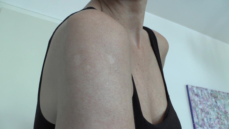 Lady Victoria Valente: 내 상완에 흉터, 레이디 빅토리아 발렌테