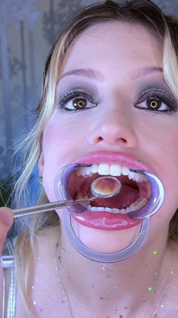 Pemeriksaan gigi ekstrem fetish gigi close-up