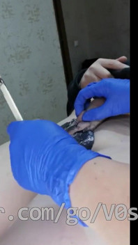 # 202 ceretta maschio con stimolazione elettrica