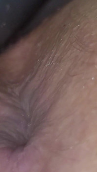 Caping Hole