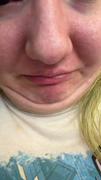 Chin Faces
