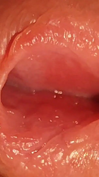 How to Widen a Glans Hole to the Extreme.