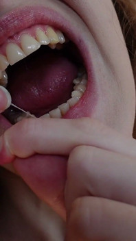 I Clean My Teeth with Dental Floss