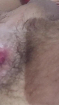 Decalaj anal