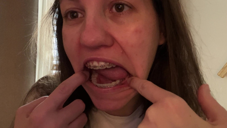 NicoleRay: Menjilati kawat gigi dengan lidah Anda