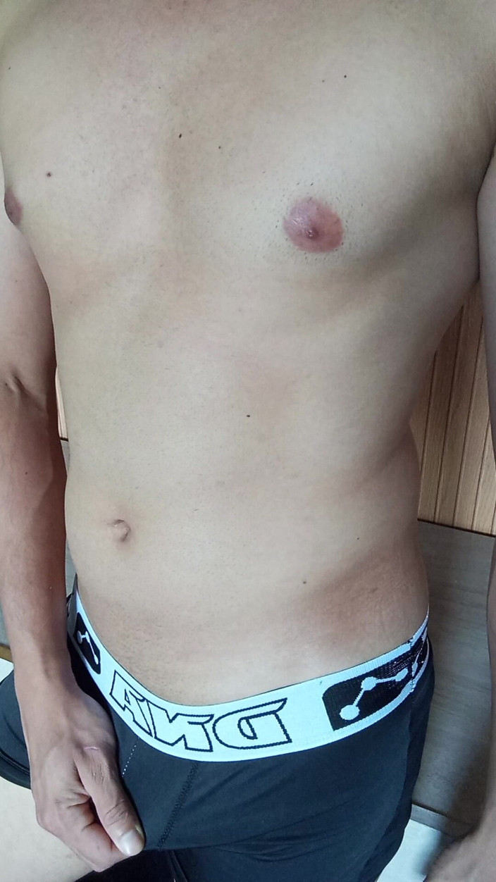 Ray Oliver: White Boy Shows Chests