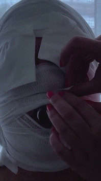 Hastane 3 - Tüm Vücut Alçısı