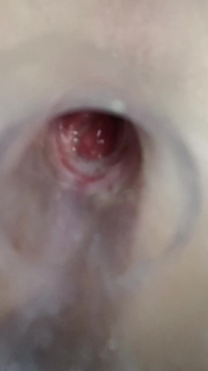 MiguellTrajano: Teraz mam gorący tyłek