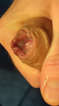 Juicy Close up