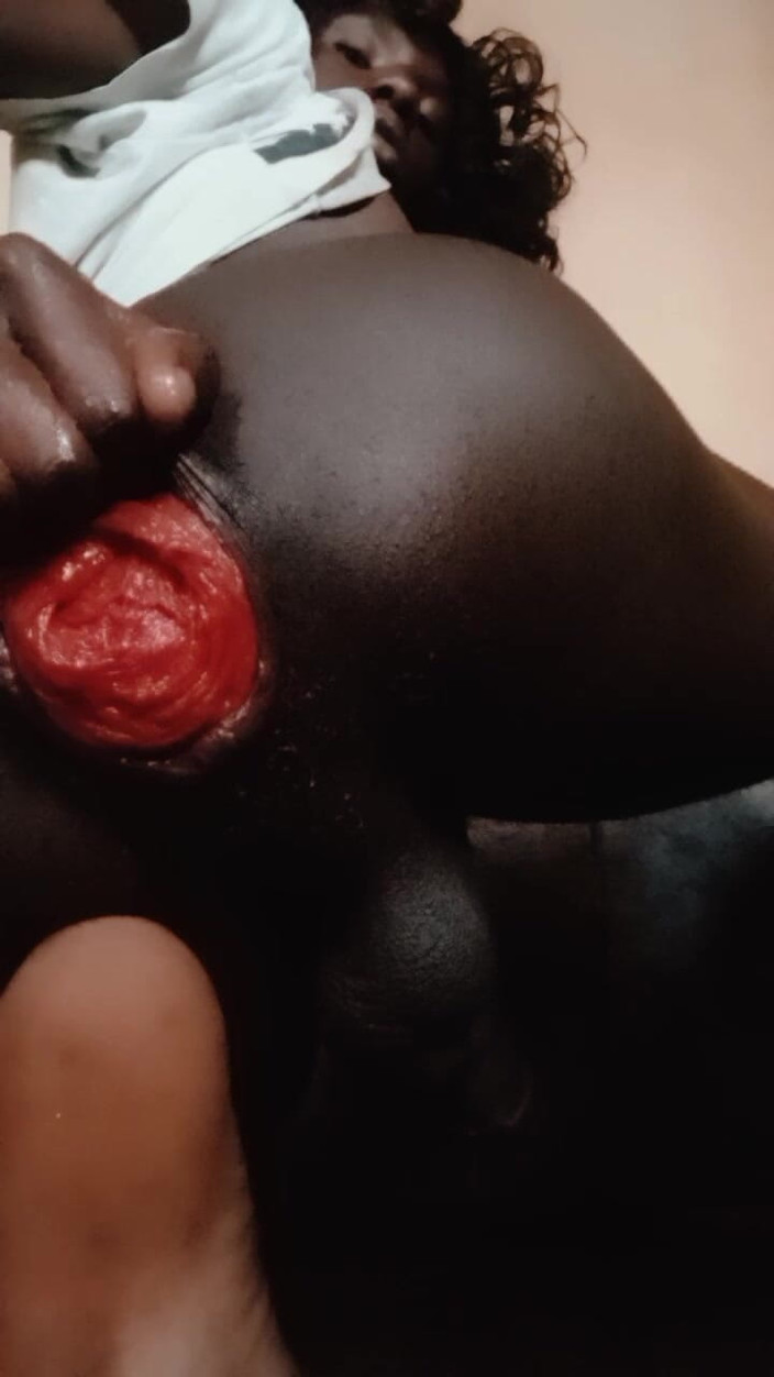 AkiraNami: Puño negro culo y prolapso