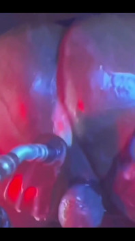 Intense Verbal Play Ahead...