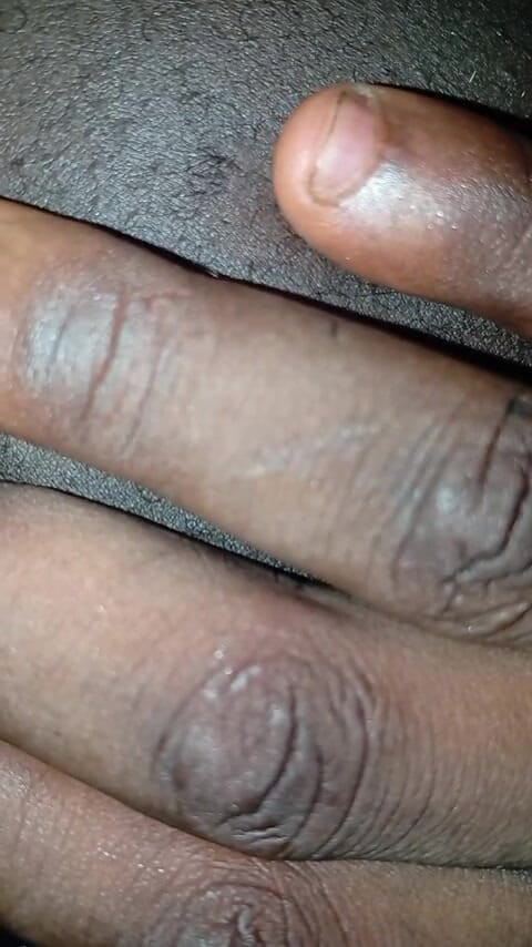 Badman4606: Černý zadek byl fistován