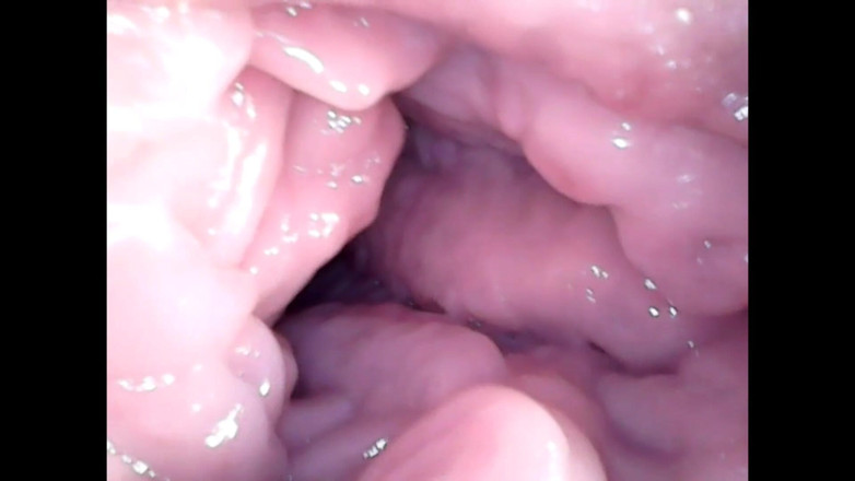 LizAngel: Endoscope in my vagina again